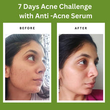 Anti Acne & Glowing | Vitamin E, Vitamin C, Salicylic acid | Derma Chemist